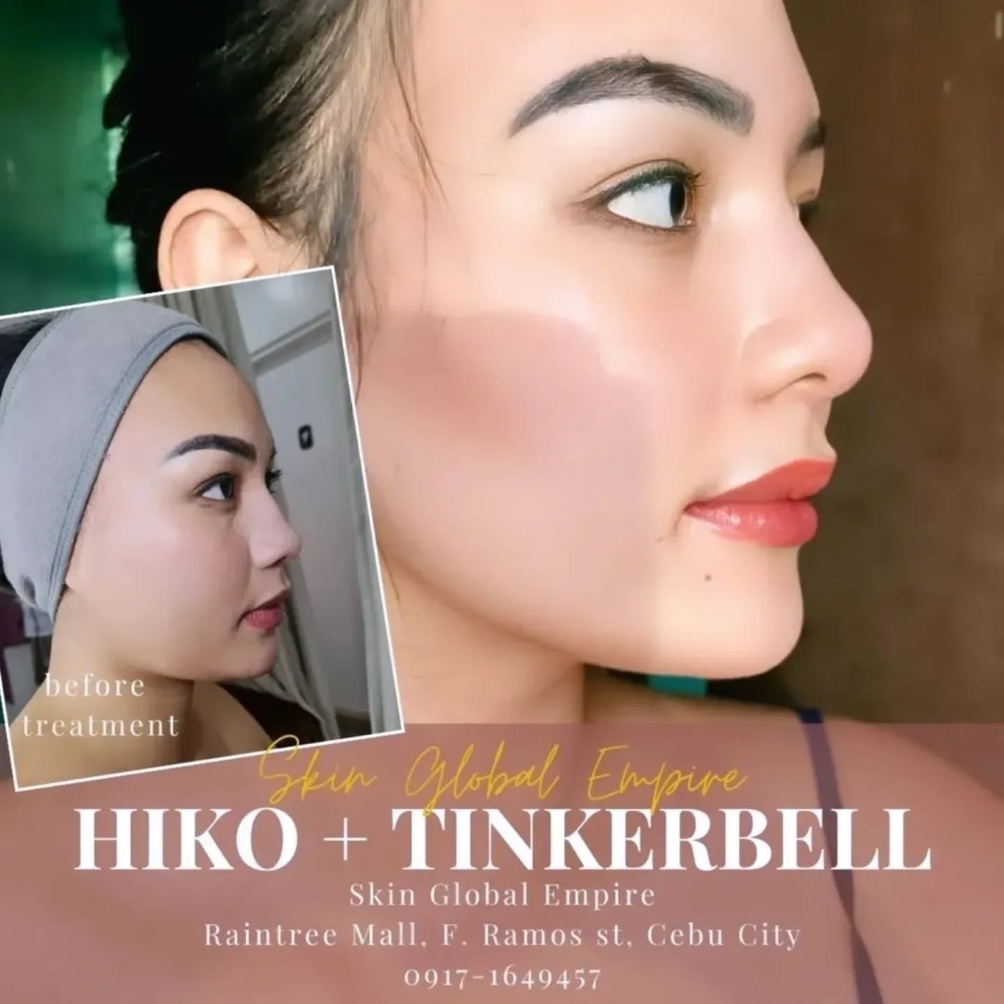 Cebu Business Directory - Skin Global Empire Aesthetic Clinic Cebu - Photo 9