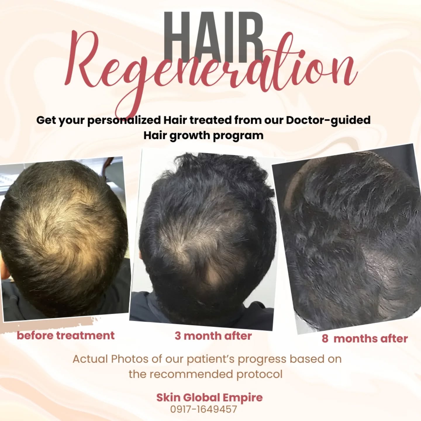 Cebu Business Directory - Hair Regeneration