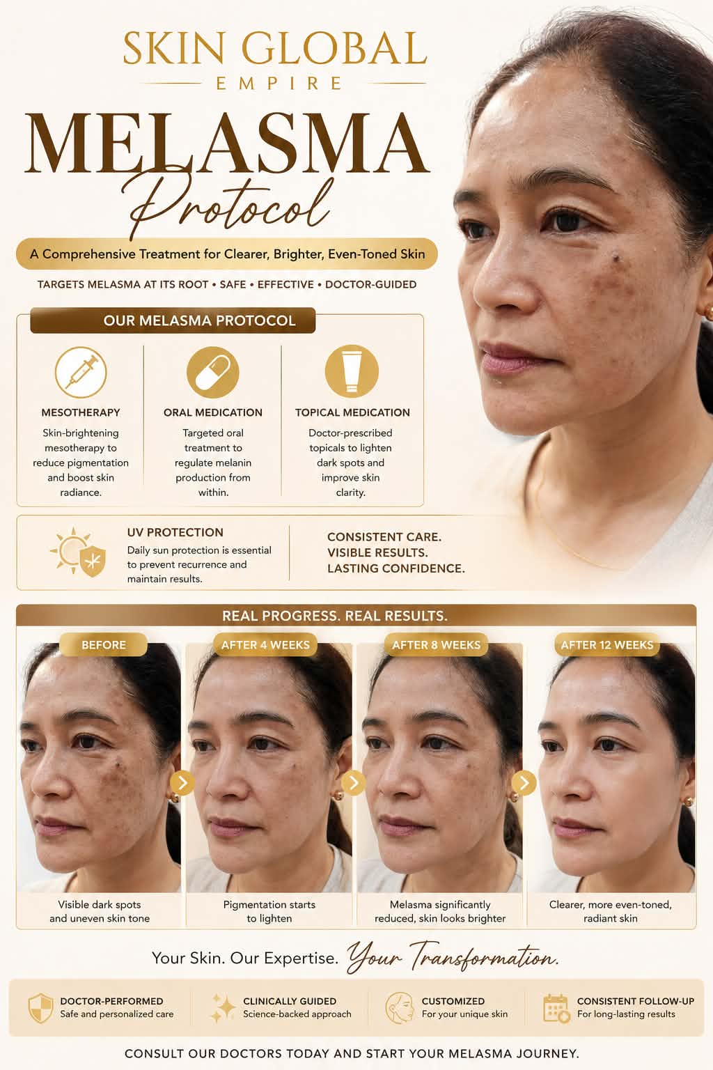 Cebu Business Directory - Melasma Treatment