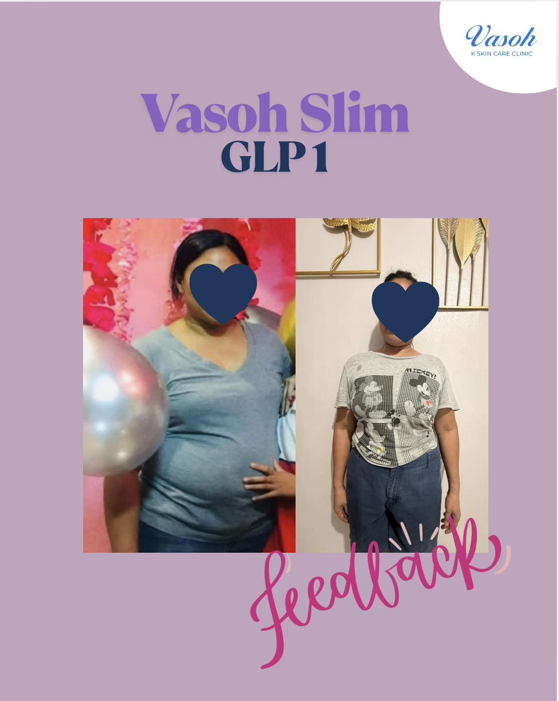 Cebu Business Directory - Vasoh K Skin Care Clinic Cebu - Photo 16
