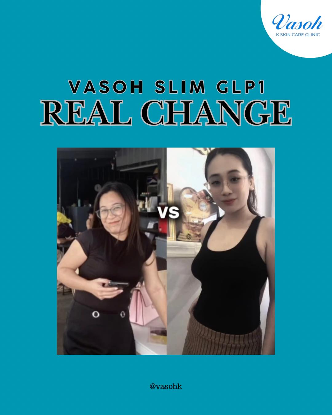 Cebu Business Directory - Vasoh K Skin Care Clinic Cebu - Photo 18