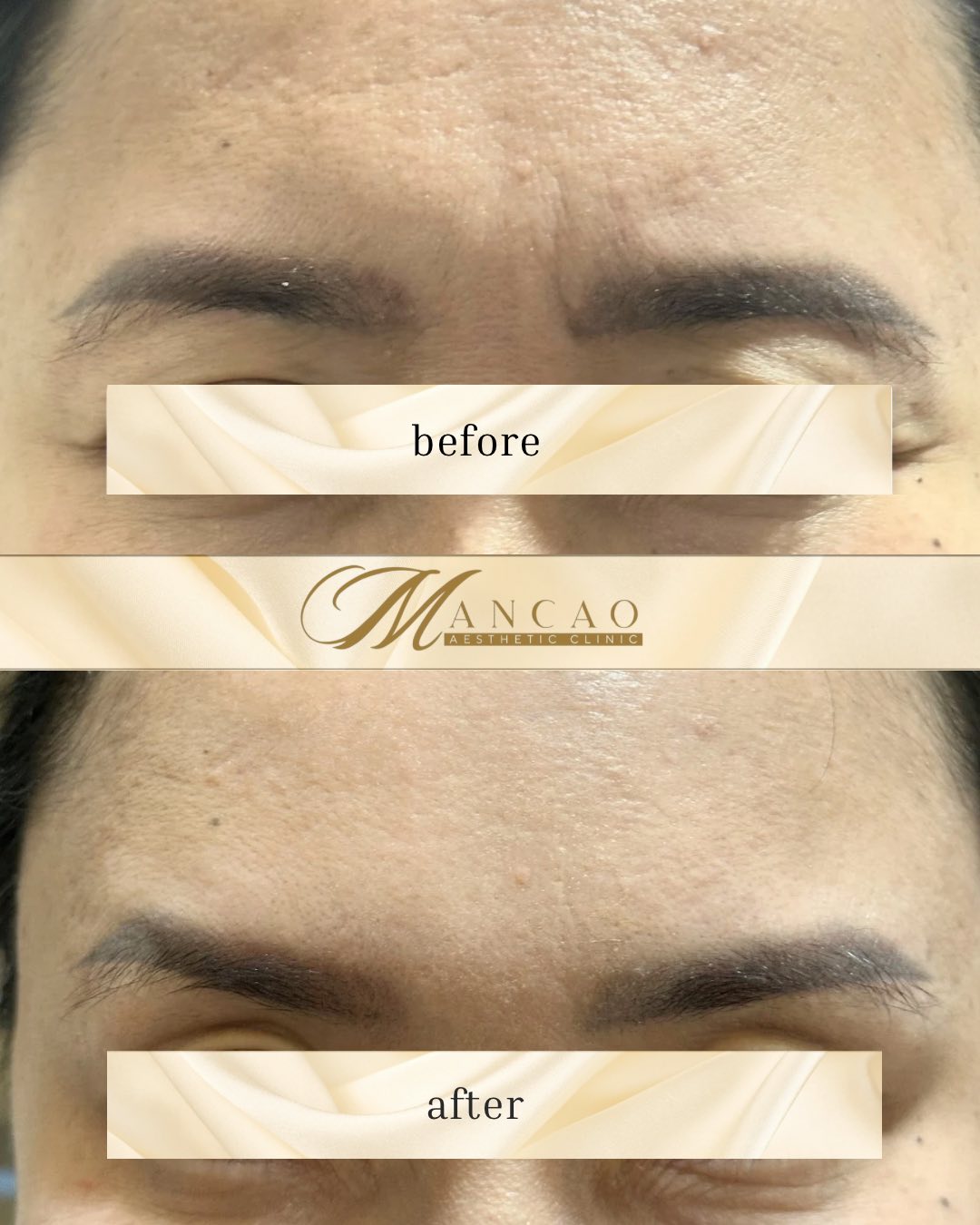 Cebu Business Directory - Skin Tightening