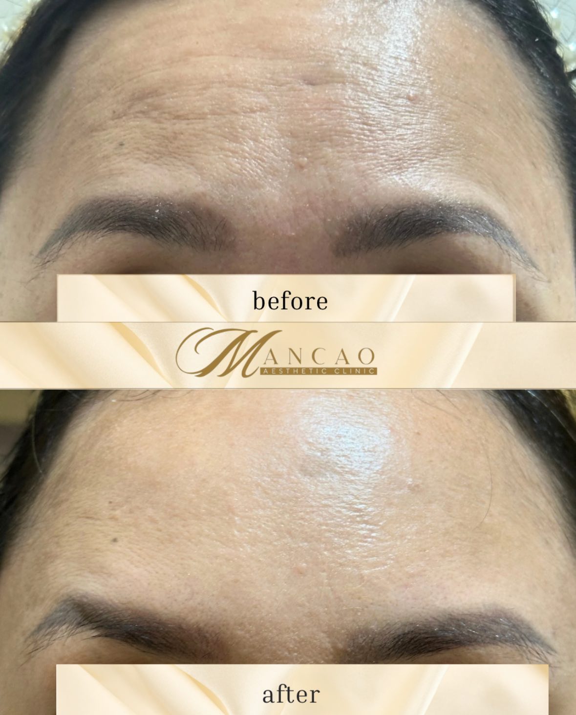 Cebu Business Directory - Skin Tightening