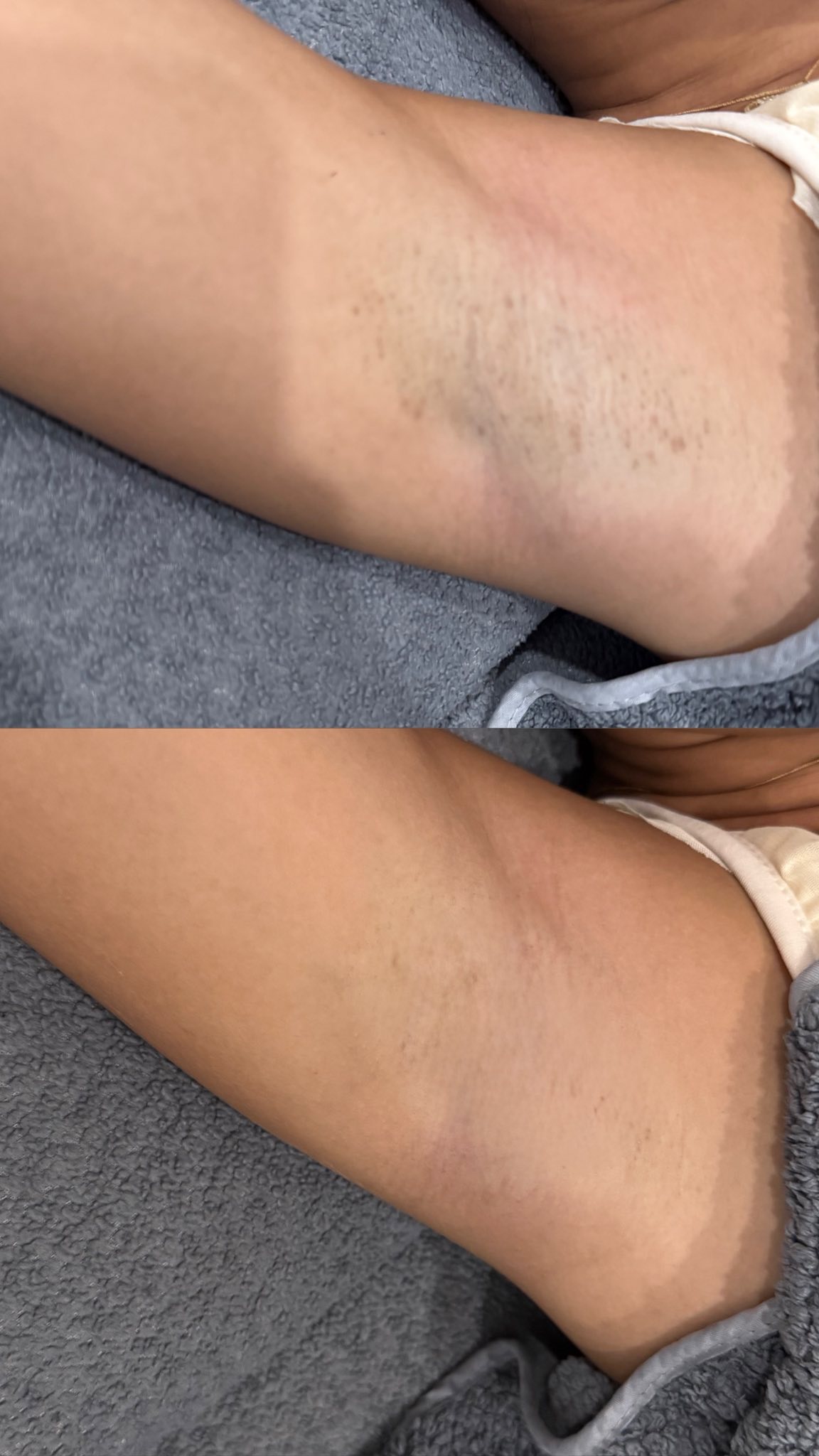 Cebu Business Directory - Underarm Whitening
