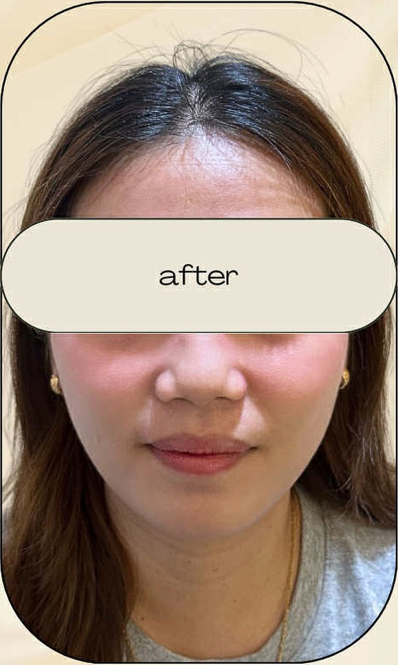 Cebu Business Directory - Jawtox - After